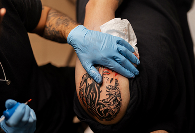 Tattoo Removal in Navi Mumbai